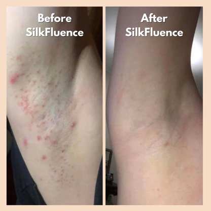 SilkFluence Clear Touch – Ingrown Hair & Dark Spot Treatment Roller